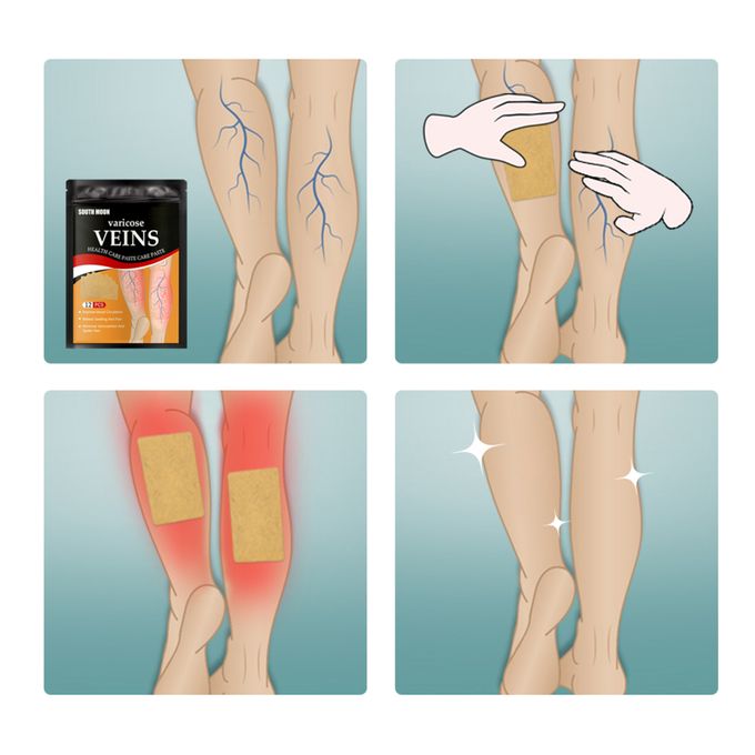 Varicose Max™ - Parches Antivarices (Pack x24 unidades)