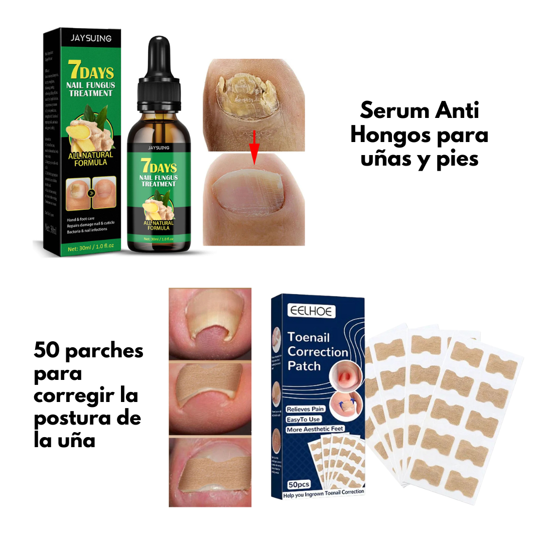 FungusKiller™ Defensa Total Serum anti hongos para Uñas y Pies