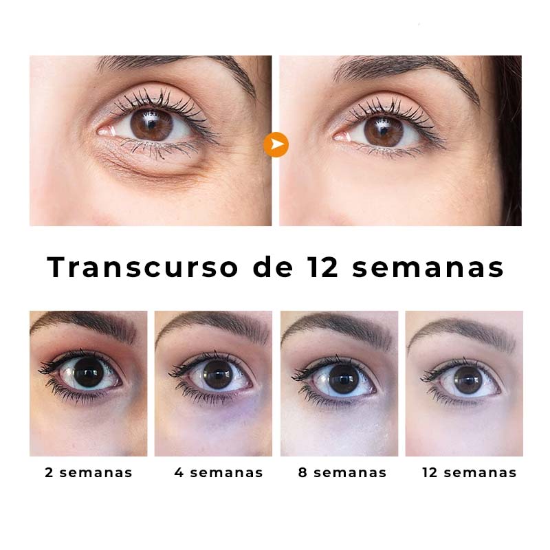 Auquest®  Serum Revitalizante para Ojeras y Bolsas - Mirada Iluminada