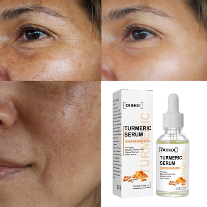 Turmeric Oil™ Serum Corrector de Manchas 4 en 1 para una piel perfecta