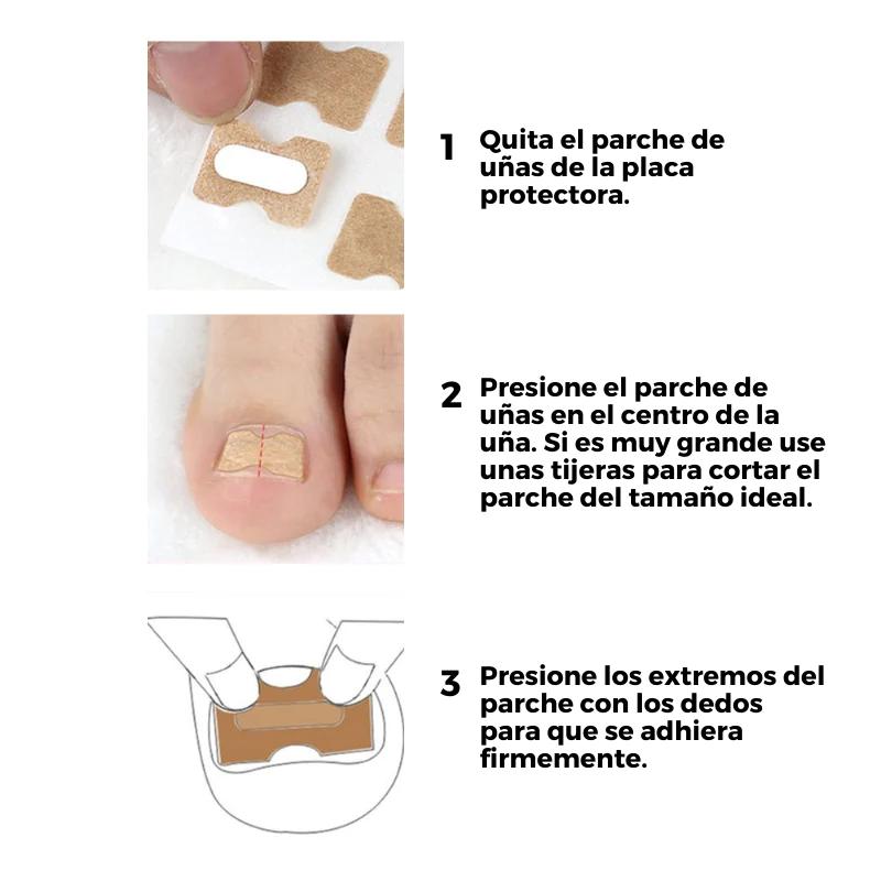 EasyPatch™ Parches Correctores de Uñas - Uñas bonitas y sanas (Pack x50 und) |