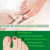 FungusKiller™ Defensa Total Serum anti hongos para Uñas y Pies