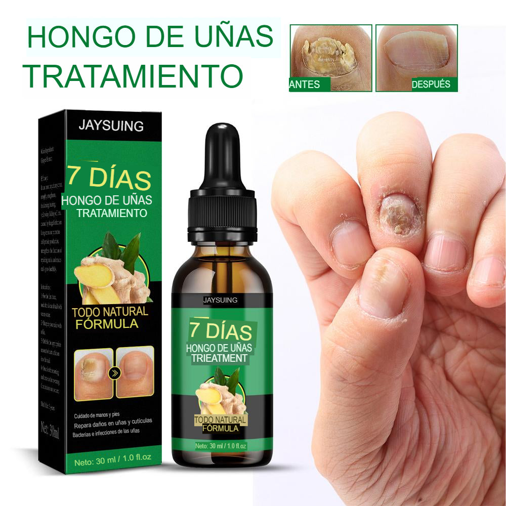 FungusKiller™ Defensa Total Serum anti hongos para Uñas y Pies