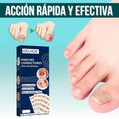 EasyPatch™ Parches Correctores de Uñas Uñeros  (Pack x50 und)