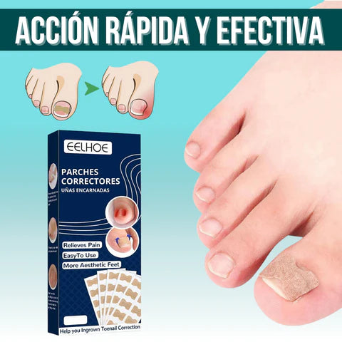 EasyPatch™ Parches Correctores de Uñas Uñeros  (Pack x50 und)
